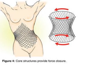 Force closure stability is generated by contractive action of core musculofascial tissues, such as the pelvic diaphragm, transverse abdominis, multifidus, and thoracolumbar fascia (Fig.4).