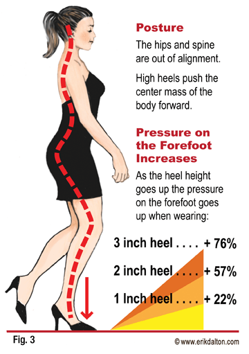 As heel height increases pressure on the forefoot increases