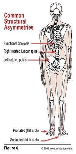 Notice in Fig. 6 how combined pronation and supination not only torsion the pelvic bowl, but initiate a functional lumbar scoliosis that spreads its tentacles through the thoracic and cervical spines.