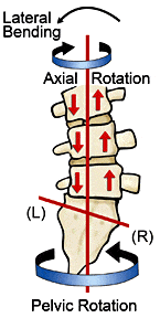 Fig. 2. SHORT right leg causing contralateral pelvic rotation.