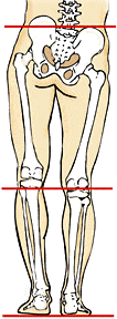 Fig. 1. Anatomic (structural) SHORT right leg.